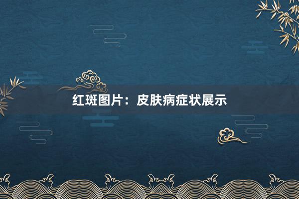 红斑图片：皮肤病症状展示